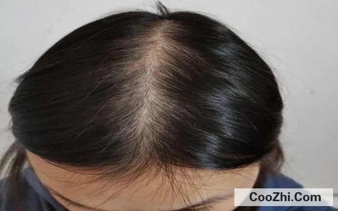 14�귢������ô����������